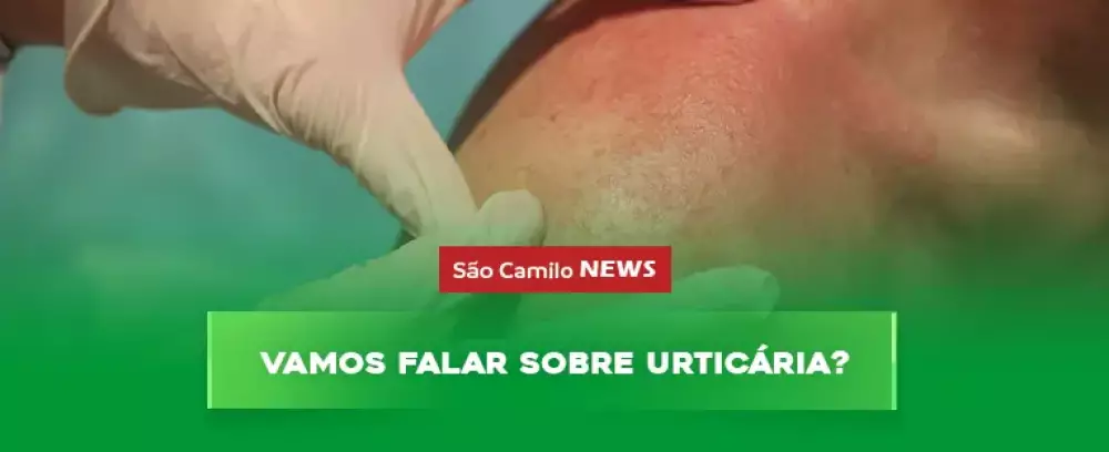 Foto da notícia Vamos falar sobre urticária?